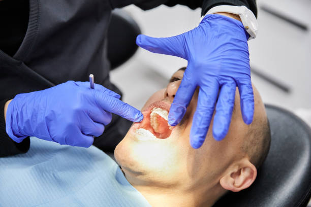 Best Emergency Wisdom Teeth Removal in Greendale, IN